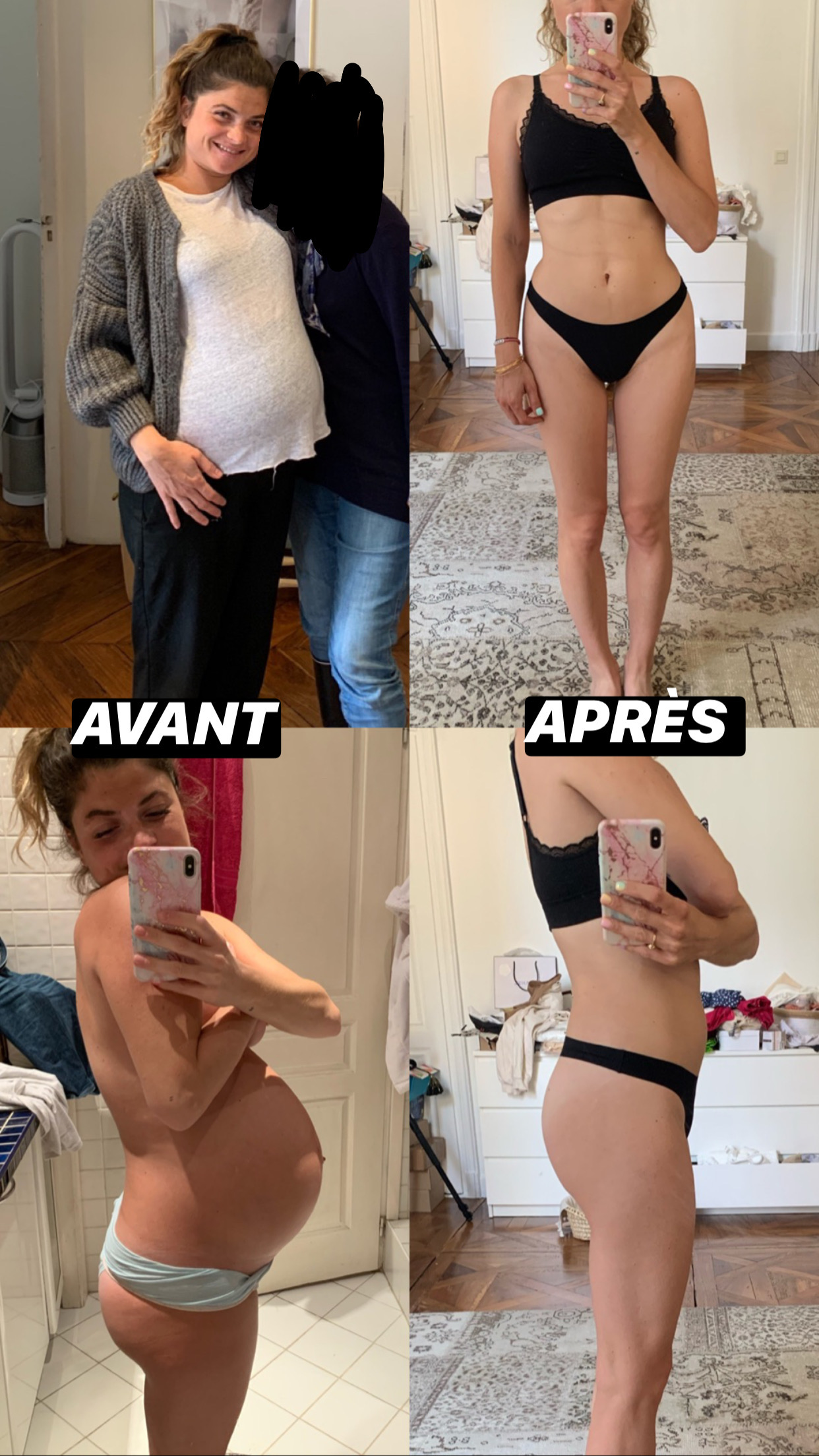 Période post-partum ou après-accouchement